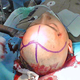Illustration for article titled Accused Game Cheater Gets Knife Through Head and Survives